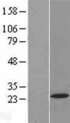 Western Blot: AP5S1 Overexpression Lysate [NBL1-08370]