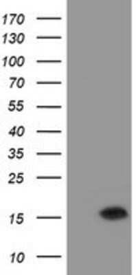 Western Blot: TMEM230 Antibody (OTI2C8) [NBP2-03751]