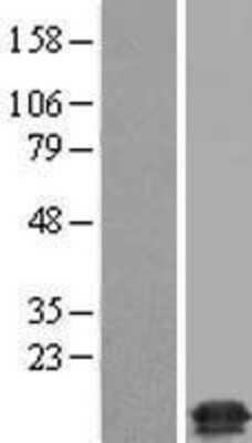 Western Blot: TMEM230 Overexpression Lysate [NBP2-09132]