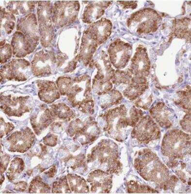 Immunohistochemistry-Paraffin: AAR2 Antibody [NBP2-30422]