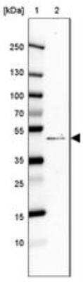 Western Blot: AAR2 Antibody [NBP2-30422]