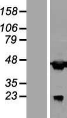 Western Blot: AAR2 Overexpression Lysate [NBL1-08374]