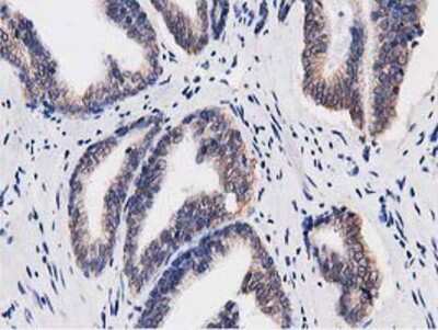 Immunohistochemistry-Paraffin: Replication Termination Factor 2 Antibody (OTI1E8) [NBP2-03584]