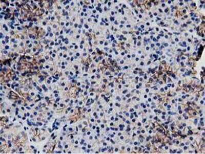 Immunohistochemistry-Paraffin: Replication Termination Factor 2 Antibody (OTI1E8) [NBP2-03584]