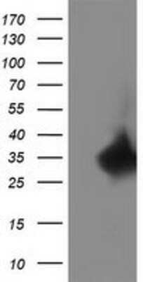 Western Blot: Replication Termination Factor 2 Antibody (OTI1E8) [NBP2-03584]