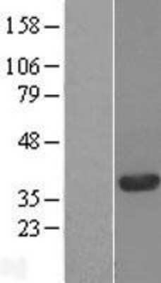 Western Blot: Replication Termination Factor 2 Overexpression Lysate [NBL1-08375]