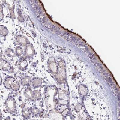 Immunohistochemistry-Paraffin: NDUFAF5 Antibody [NBP2-14400]