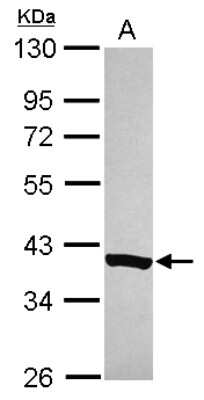 Western Blot: NDUFAF5 Antibody [NBP2-15644]