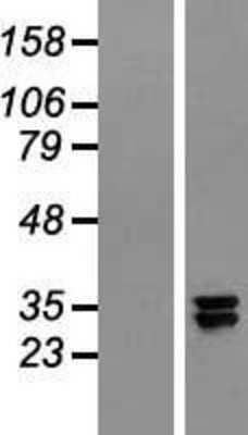 Western Blot: NDUFAF5 Overexpression Lysate [NBL1-08377]