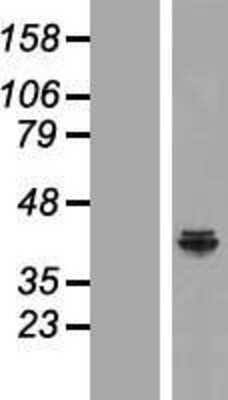 Western Blot: NDUFAF5 Overexpression Lysate [NBP2-06351]