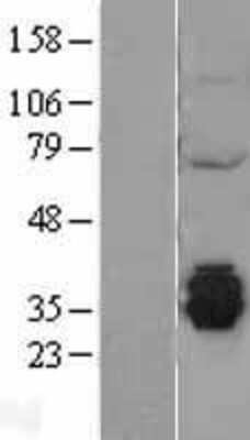 Western Blot: MGME1 Overexpression Lysate [NBL1-08379]