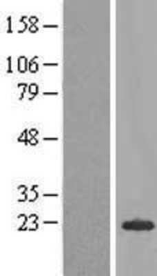 Western Blot: SCP2D1 Overexpression Lysate [NBL1-08381]