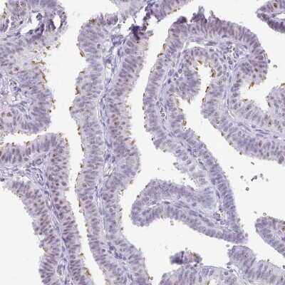 Immunohistochemistry-Paraffin: LLC1 Antibody [NBP2-31709]