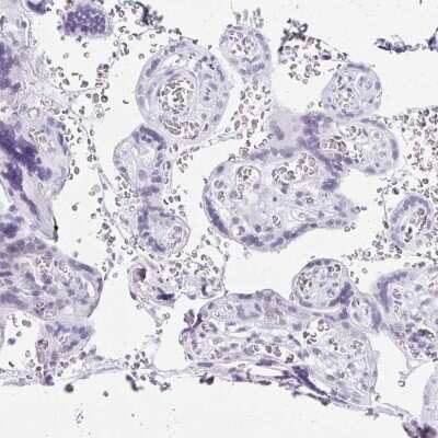 Immunohistochemistry-Paraffin: LLC1 Antibody [NBP2-31709]