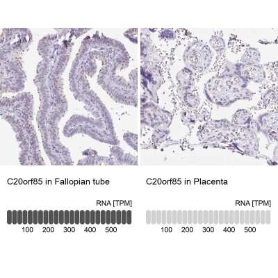 Immunohistochemistry-Paraffin: LLC1 Antibody [NBP2-31709]