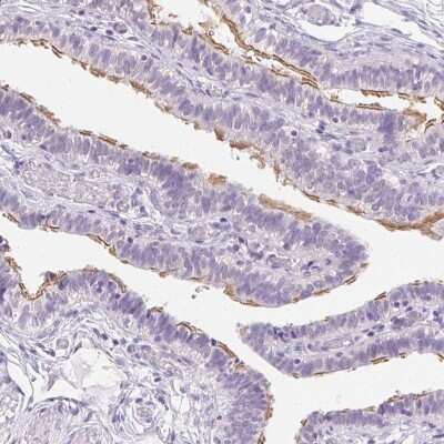 Immunohistochemistry-Paraffin: LLC1 Antibody [NBP2-49451]