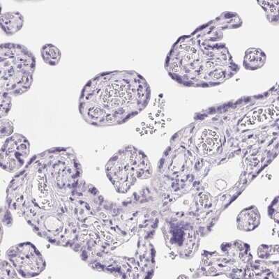 Immunohistochemistry-Paraffin: LLC1 Antibody [NBP2-49451]