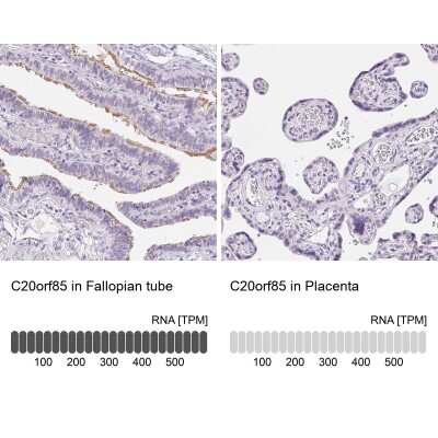 Immunohistochemistry-Paraffin: LLC1 Antibody [NBP2-49451]