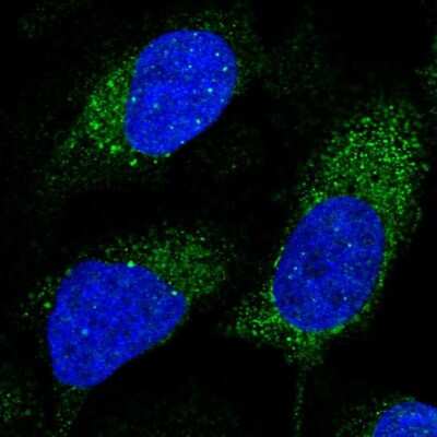 Immunocytochemistry/ Immunofluorescence: SLX4 Interacting Protein Antibody [NBP2-14567]