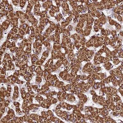 Immunohistochemistry-Paraffin: SLX4 Interacting Protein Antibody [NBP2-14567]