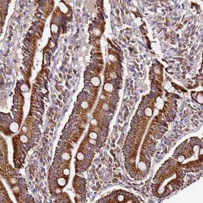 Immunohistochemistry-Paraffin: SLX4 Interacting Protein Antibody [NBP2-14567]