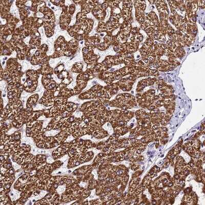 Immunohistochemistry-Paraffin: SLX4 Interacting Protein Antibody [NBP2-14567]
