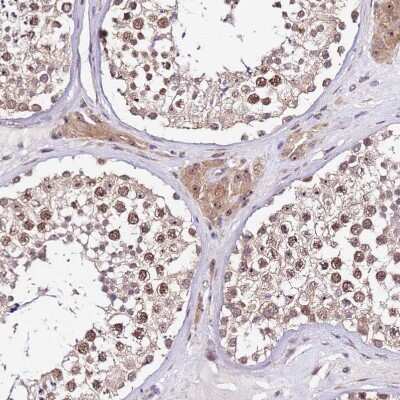 Immunohistochemistry-Paraffin: SLX4 Interacting Protein Antibody [NBP2-14567]