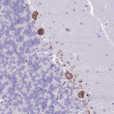 Immunohistochemistry-Paraffin: C20orf96 Antibody [NBP2-14649]