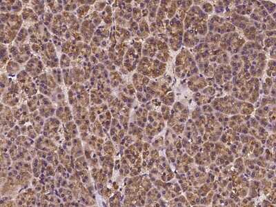 Immunohistochemistry-Paraffin: C20orf96 Antibody [NBP2-98041]