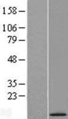 Western Blot: C21orf119 Overexpression Lysate [NBL1-08383]