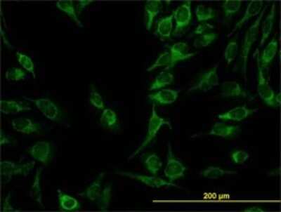 Immunocytochemistry/ Immunofluorescence: GATD3A Antibody (1F5) [H00008209-M01]