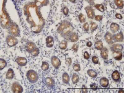 Immunohistochemistry-Paraffin: GATD3A Antibody (1F5) [H00008209-M01]