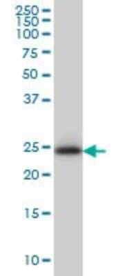 Western Blot: GATD3A Antibody (1F5) [H00008209-M01]