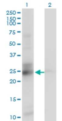 Western Blot: GATD3A Antibody (1F5) [H00008209-M01]