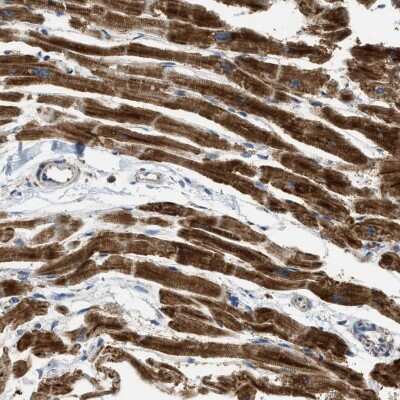 Immunohistochemistry: GATD3A Antibody [NBP2-47532]