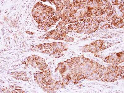 Immunohistochemistry-Paraffin: GATD3A Antibody [NBP2-15645]