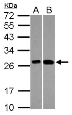 Western Blot: GATD3A Antibody [NBP2-15645]