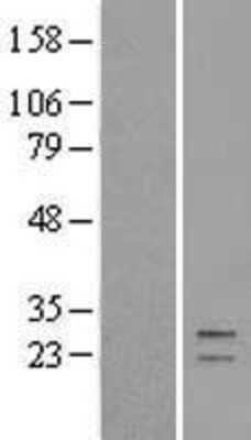 Western Blot: GATD3A Overexpression Lysate [NBL1-08385]