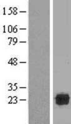 Western Blot: SPATC1L Overexpression Lysate [NBP2-06053]