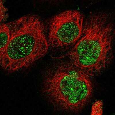 Immunocytochemistry/ Immunofluorescence: C21orf58 Antibody [NBP1-85912]