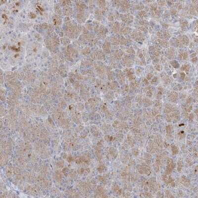 Immunohistochemistry: C21orf58 Antibody [NBP2-47531]
