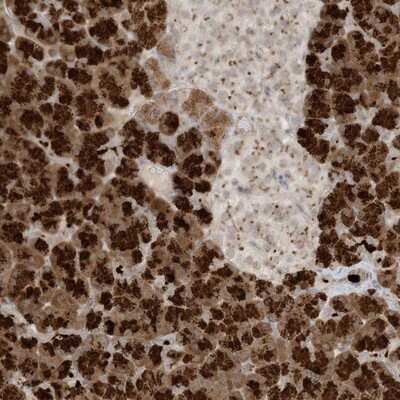 Immunohistochemistry-Paraffin: C21orf58 Antibody [NBP1-85912]