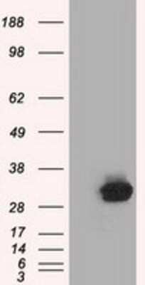 Western Blot: C21orf59 Antibody (OTI2H5) [NBP2-02702]