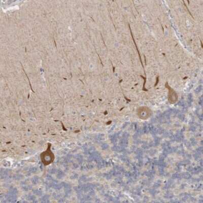 Immunohistochemistry-Paraffin: C21orf59 Antibody [NBP1-88275]