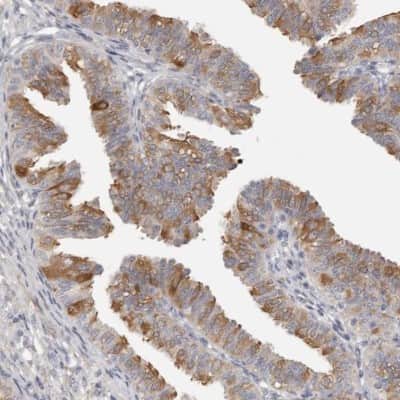 Immunohistochemistry-Paraffin: C21orf59 Antibody [NBP1-88275]