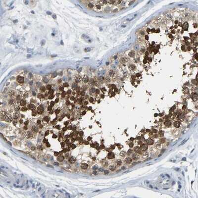 Immunohistochemistry-Paraffin: C21orf59 Antibody [NBP1-88276]