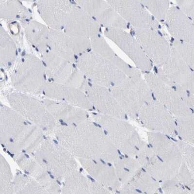 Immunohistochemistry-Paraffin: C21orf59 Antibody [NBP1-88277]