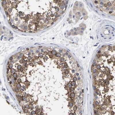 Immunohistochemistry-Paraffin: C21orf59 Antibody [NBP1-88277]