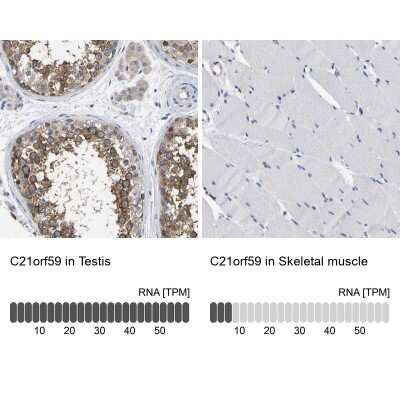 Immunohistochemistry-Paraffin: C21orf59 Antibody [NBP1-88277]