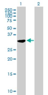 Western Blot: C21orf59 Antibody [H00056683-B01P]